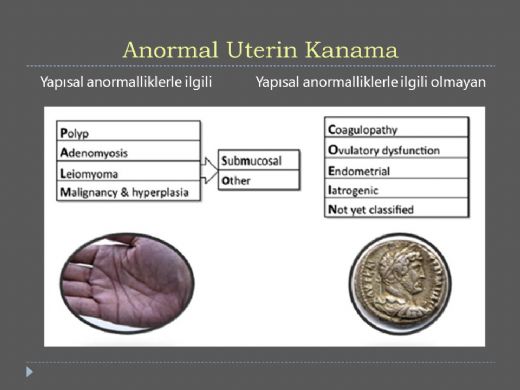 Anormal Uterin Kanama